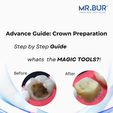 Best crown preparation guide ever from step one to ten