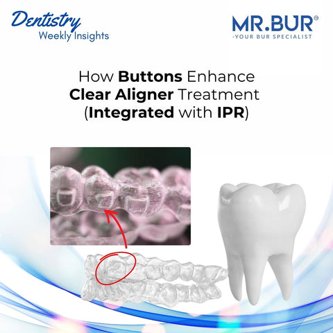 Buttons enhance clear aligner treatment by improving control and precision, integrated with IPR using Mr. Bur One Slice IPR Kit.