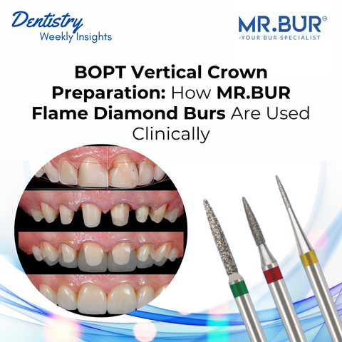 BOPT vertical crown preparation clinical guide featuring anterior tooth preparation stages and MR.BUR flame diamond burs in coarse, fine and super-fine grits.