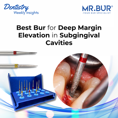 Mr. Bur explores root canal retreatment criteria including obturation quality apical lesions symptoms and clinical evaluation.