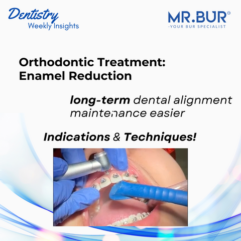 Dental Insight: Enamel Reduction Procedures in Orthodontic Treatment