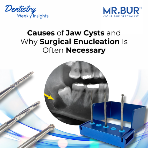 Mr. Bur Lindemann Kit HP supports precise bone removal and controlled surgical access during jaw cyst enucleation procedures in oral surgery.