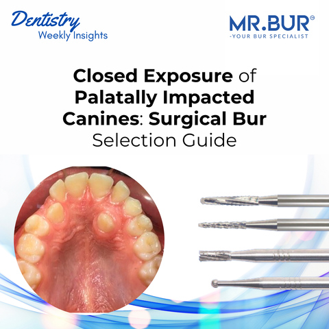 Closed Exposure of Palatally Impacted Canines: Surgical Bur Selection Guide