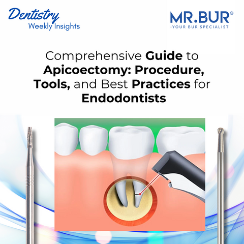 Mr. Bur surgical burs play a vital role in the apicoectomy procedure, providing precision in removing infected tissue at the root tip.