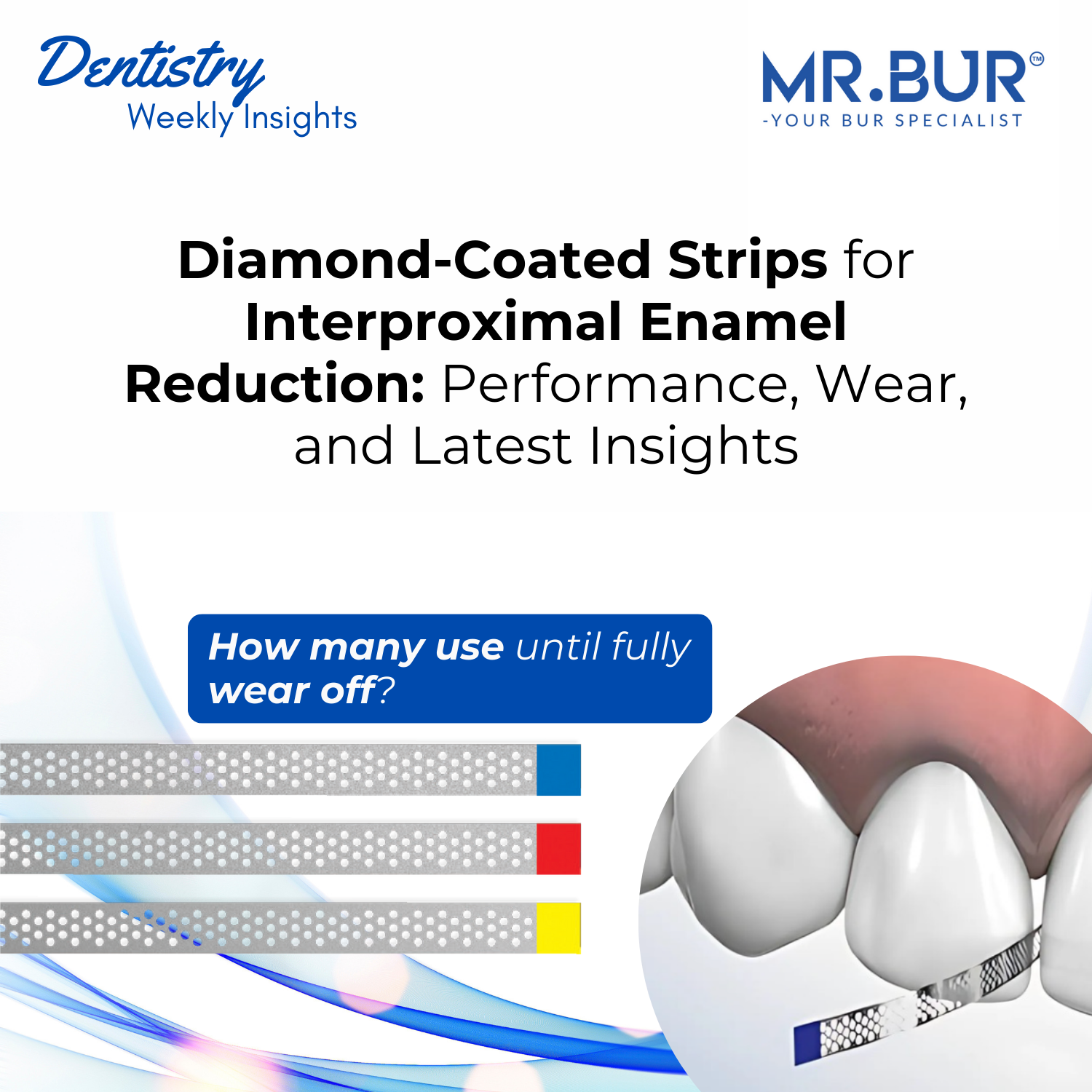 Diamond-Coated Strips for Interproximal Enamel Reduction: Performance ...