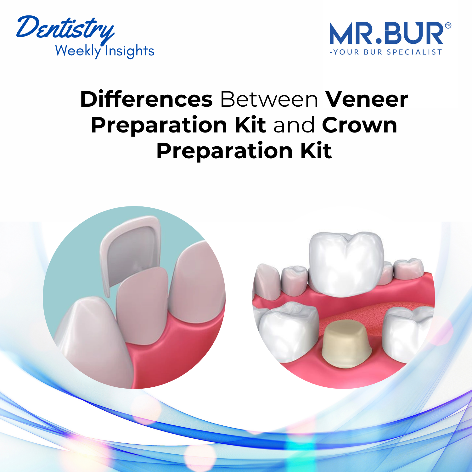 Veneer vs. Crown Preparation Kits: Key Differences and Clinical Applic ...