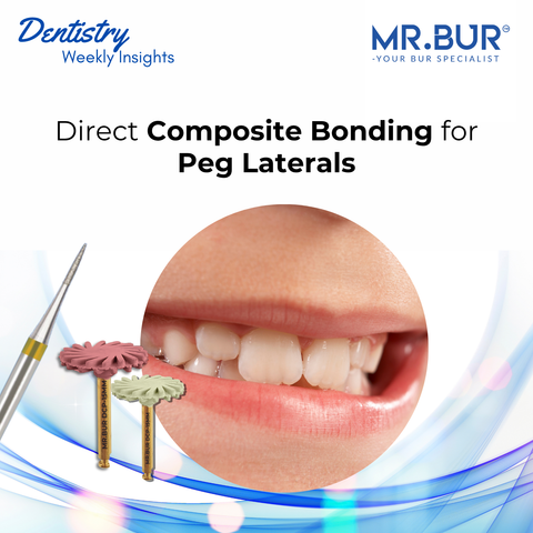 MR.Bur direct composite bonding for peg laterals showing a peg-shaped lateral incisor case with finishing diamond bur and composite polishing instruments for cosmetic restorative dentistry.