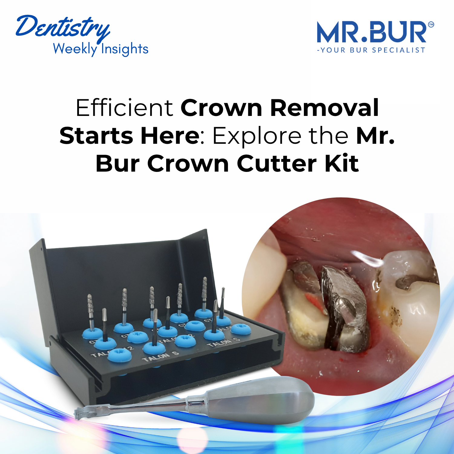 Scrow Cutter Efficient Crown Removal with the Mr. Bur Crown Cutter Kit: Precision ...