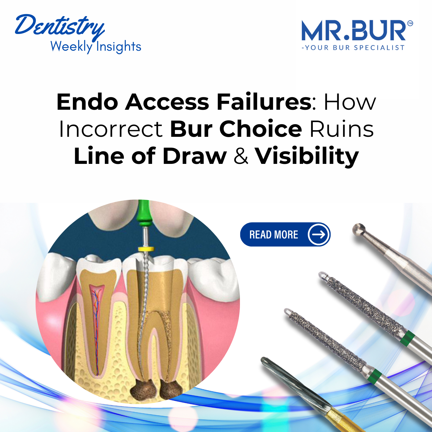 Bur Using Png Endo Access Failures: How Incorrect Bur Choice Ruins Line of Draw & Vi ...