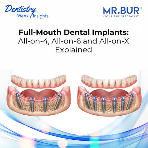 MR.BUR cover comparing All-on-4 and All-on-6 full-mouth dental implants, showing four versus six titanium implants supporting fixed full-arch restorations.