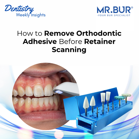MR.BUR Debonding Kit PROMAX with carbide burs and dental polishers beside an intraoral scanner capturing teeth with residual orthodontic adhesive before retainer fabrication.