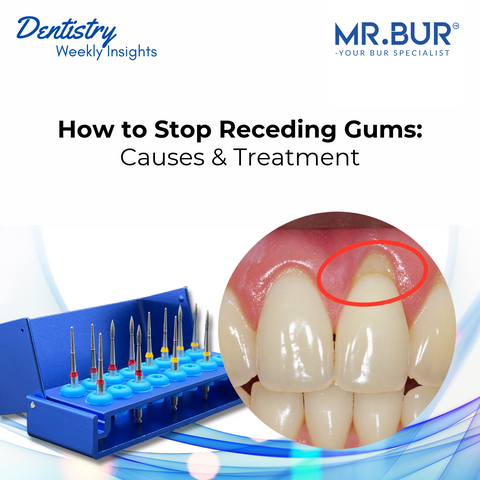 MR.BUR “How to Stop Receding Gums: Causes & Treatment” blog cover showing a circled exposed tooth root and a surgical root planing bur kit.