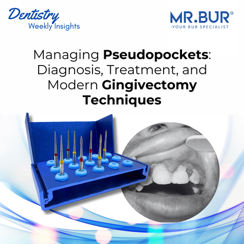 Mr. Bur managing pseudopockets guide showing gingivectomy bur kit and clinical gingival overgrowth diagnosis for modern periodontal treatment.