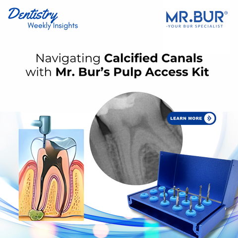 Navigating calcified canals with Mr. Bur’s Pulp Access Kit, designed for safe and efficient endodontic access through sclerotic dentin using high-performance carbide and diamond burs.