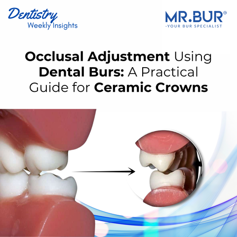 MR.BUR occlusal adjustment using dental burs cover image showing ceramic crown contact refinement and a practical guide for ceramic crown finishing