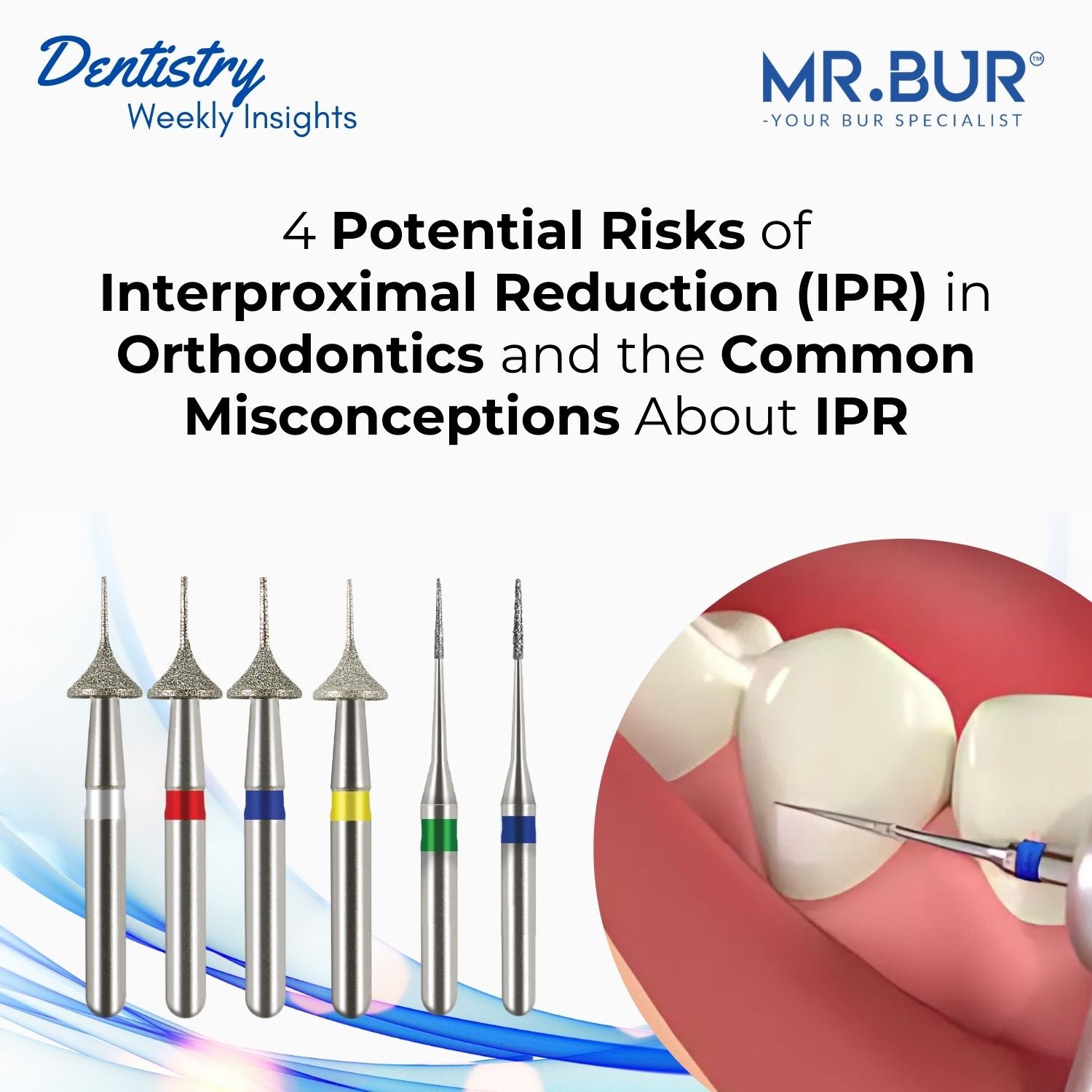 Top 4 Risks and Common Misconceptions of IPR in Orthodontics MR BUR US ...