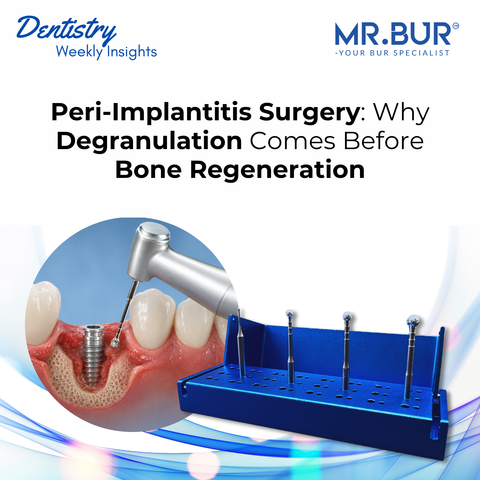 Peri-Implantitis Surgery: Why Degranulation Comes Before Bone Regeneration