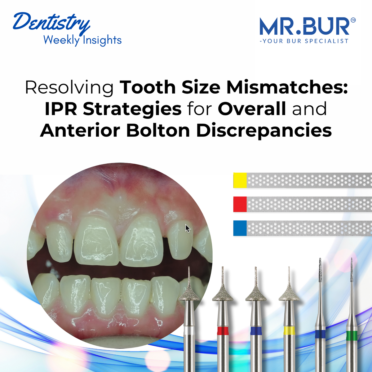 Oral Microbiome and Its Impact on Dental Health – Mr Bur