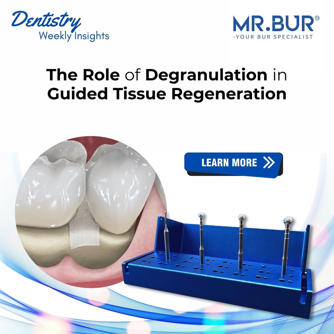 Degranulation in Flap Surgery and The Crucial Steps for Successful ...