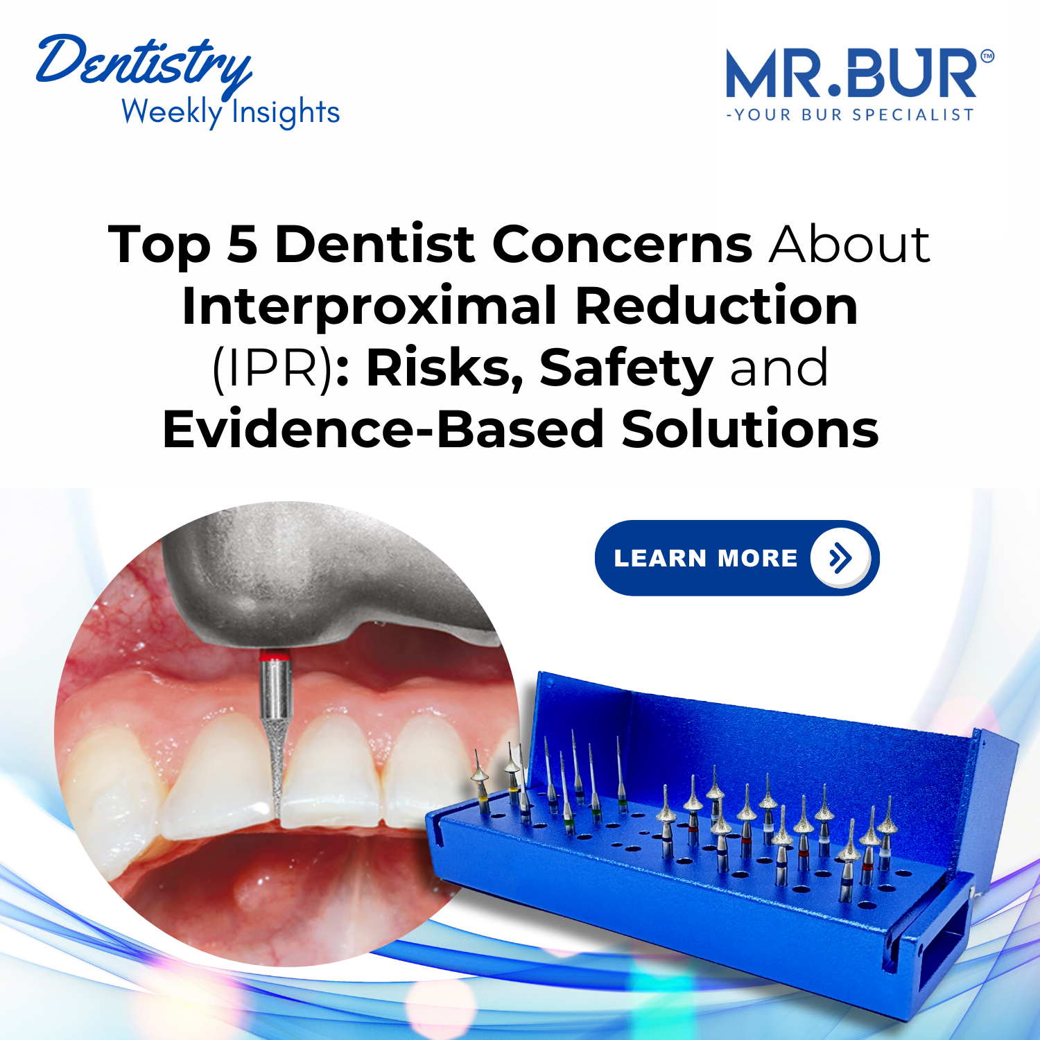 Ipra Risk Top 5 Dentist Concerns About Interproximal Reduction (IPR): Risks, Saf ...