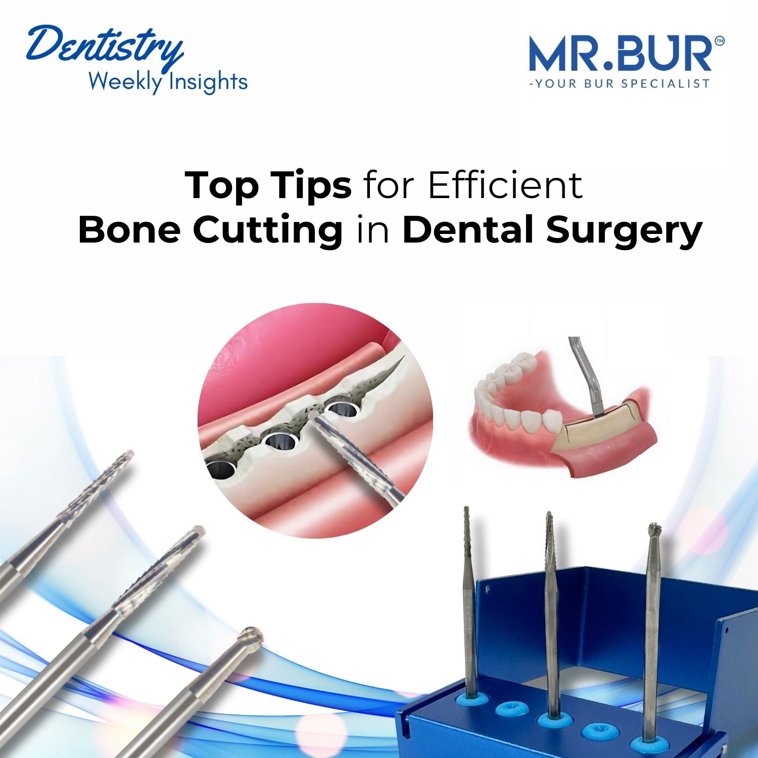 Stackable Guide Bone Cuting Expert Tips for Precise and Efficient Bone Cutting in Dental Surgery ...