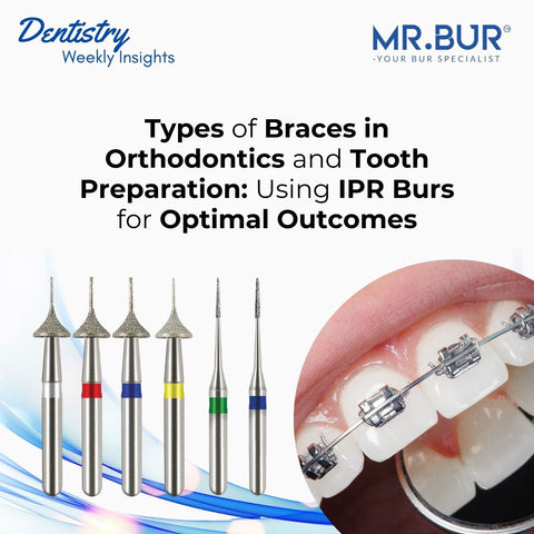 Ipr Tools One Slice IPR Kit vs. Traditional Tools: Enhancing Interproximal ...