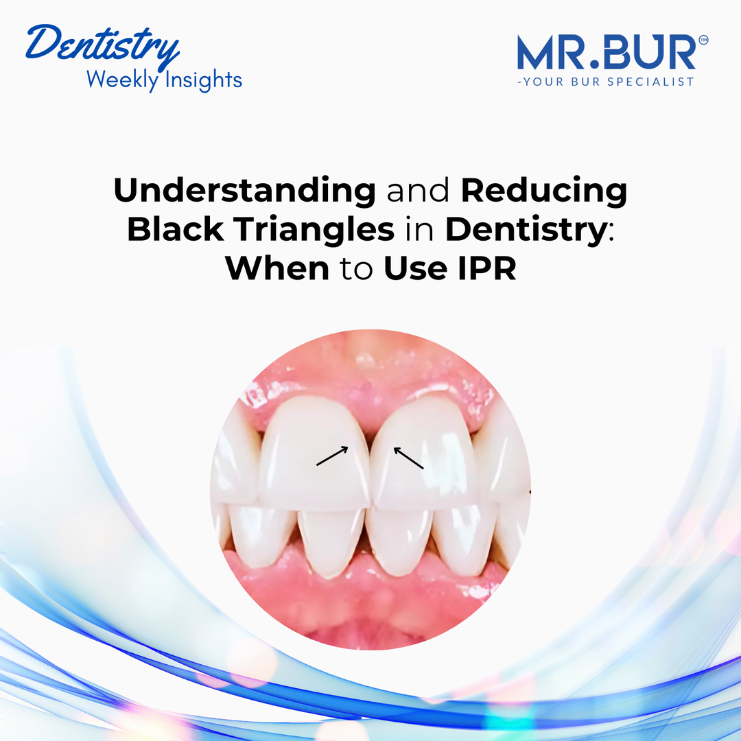 The Key Applications of Fissure Carbide Burs in Dentistry – Mr Bur