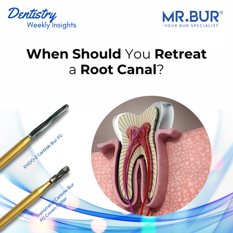 Mr. Bur END0-Z Carbide Bur FG and Transmetal Carbide Bur FG Crown Cutter used for root canal retreatment access and crown removal.