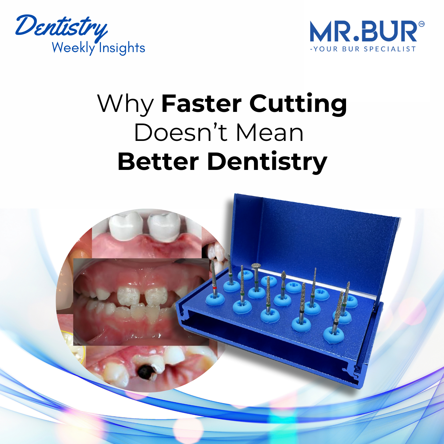 Why Faster Cutting Doesn’t Mean Better Dentistry – Mr Bur