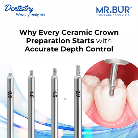 Image of a depth marking diamond bur preparing the facial surface of an anterior tooth for a ceramic veneer restoration.