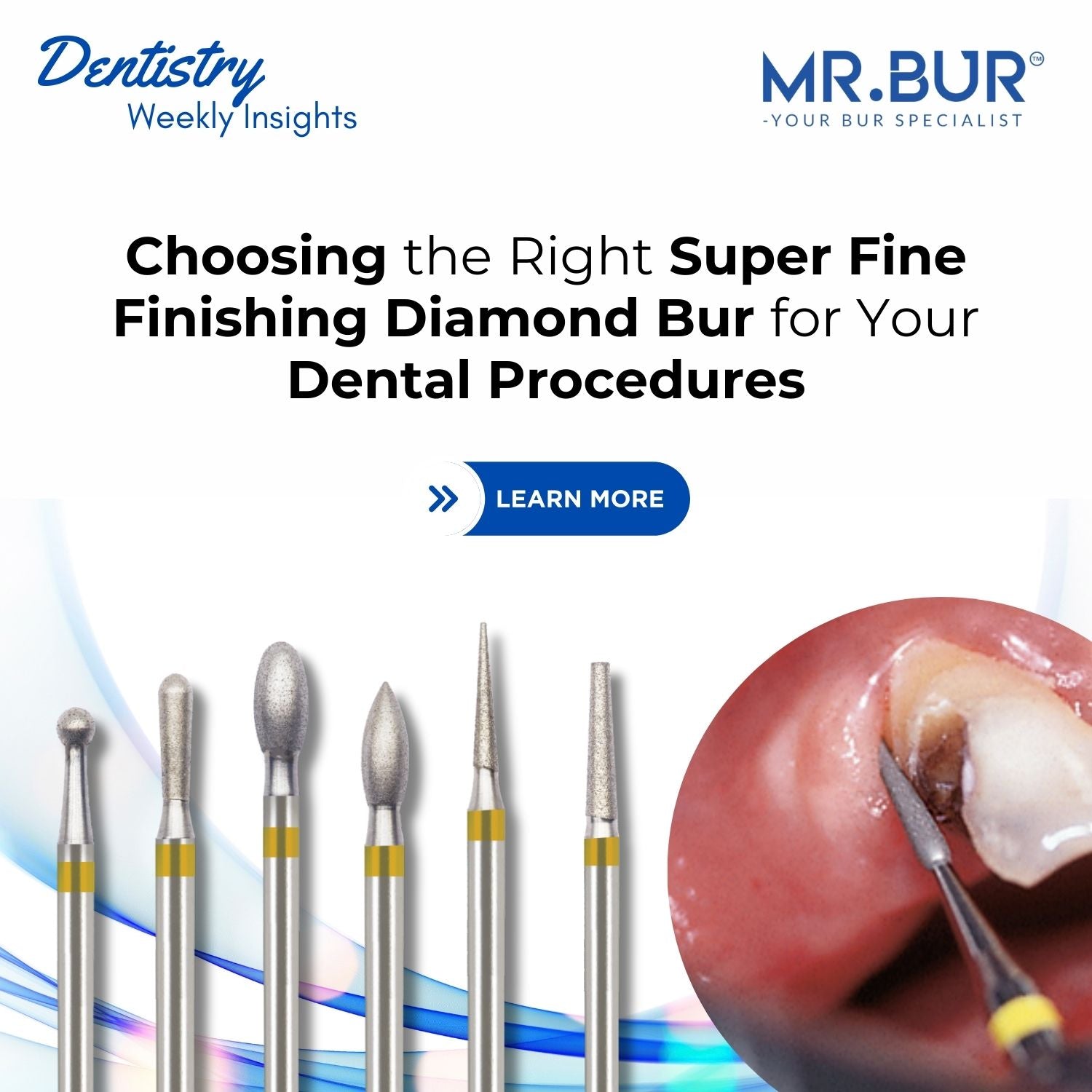Diamond Butler Finish Choosing the Right Super Fine Finishing Diamond Bur for Your Dental ...