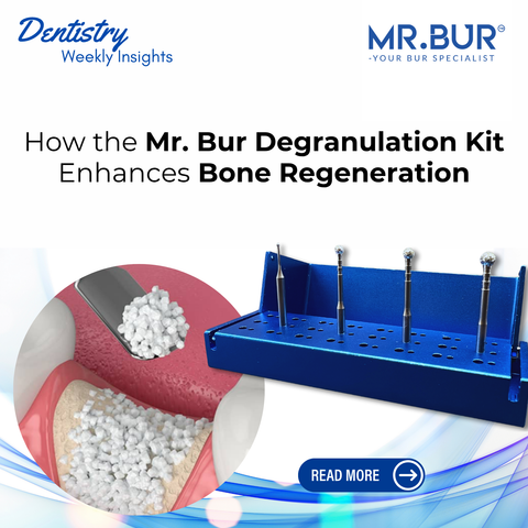 Mr Bur Degranulation Kit illustration showing bone grafting process and surgical burs for enhanced bone regeneration in implantology and periodontal surgery.
