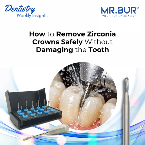 How to Remove Zirconia Crowns Safely Without Damaging the Tooth