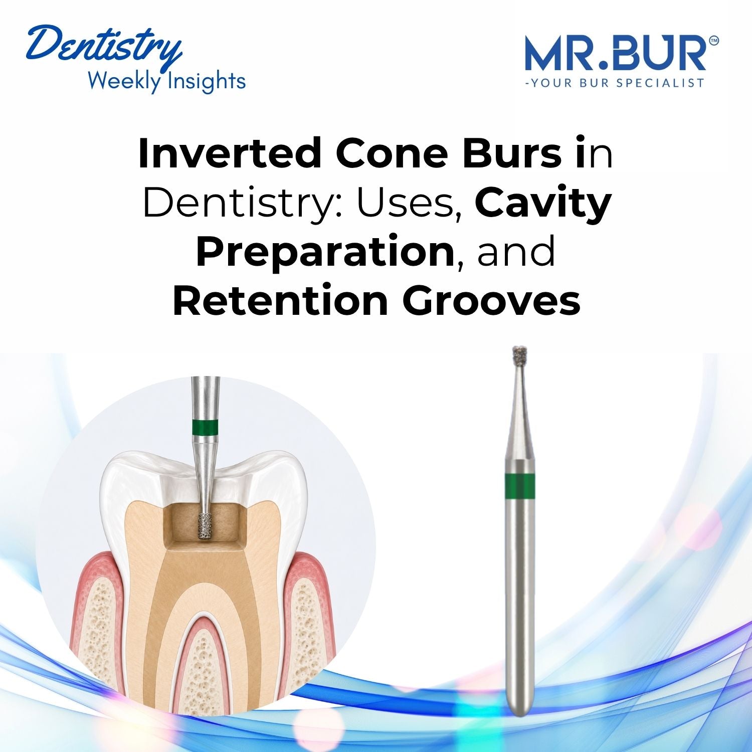 Inverted Cone Burs in Dentistry: Uses, Cavity Preparation, and Retenti ...