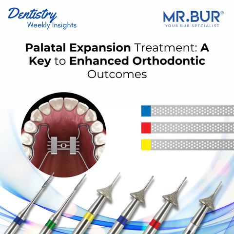 Mr. Bur highlights palatal expansion treatment as a crucial step for enhanced orthodontic outcomes, improving alignment and jaw symmetry.