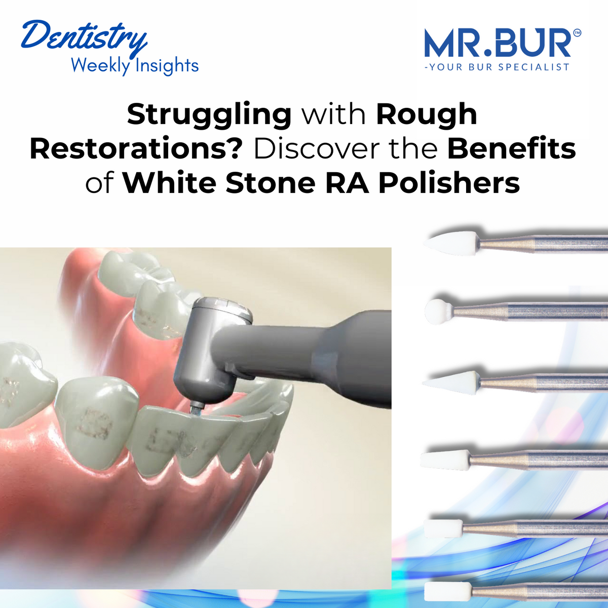 IPR and Clear Aligners: How Proper Reduction Shapes Predictable Tooth ...