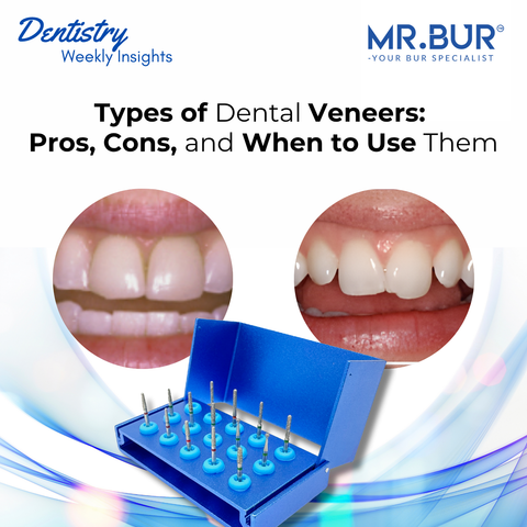 Mr. Bur veneer preparation kit FG shown with dental veneer before and after cases highlighting types of veneers with their pros cons and clinical use.