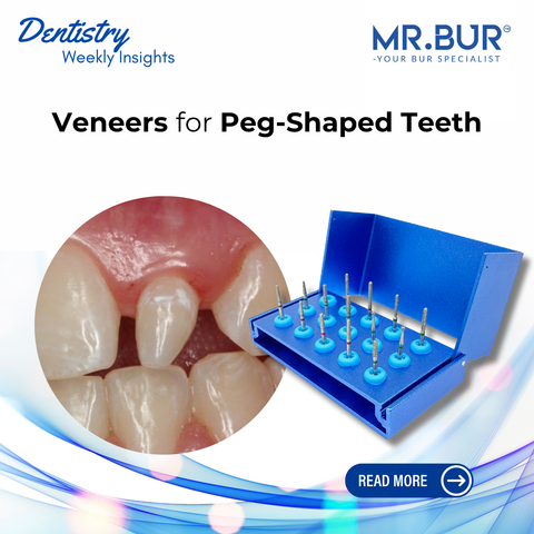 Mr Bur Veneer Preparation Kit FG used for veneers in peg shaped teeth. Precise enamel reduction, smooth margin refinement, and aesthetic restoration for anterior teeth.