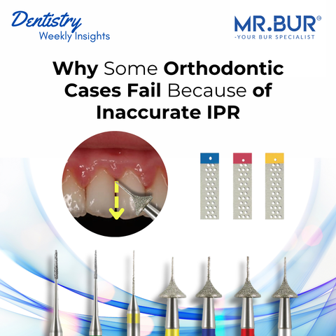 Mr. Bur One Slice IPR Kit used for accurate one-time interproximal reduction demonstrating controlled enamel reduction in orthodontic treatment.