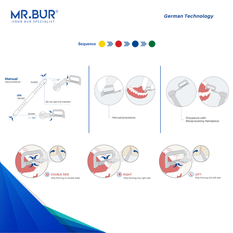 MR.BUR IPR Strip System 1.0 interproximal reduction strips process in orthodontic treatment.