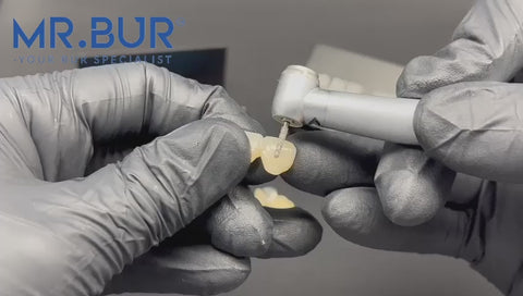Mr. Bur Crown Cutter Hybrid Twister Super Coarse Diamond Bur FG ensures fast, precise crown removal with superior cutting efficiency and durability for optimal dental procedures.